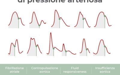 La forma dell’onda di pressione arteriosa