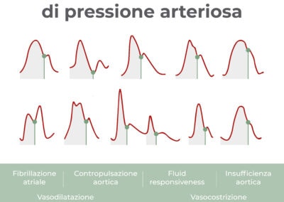 La forma dell’onda di pressione arteriosa